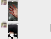 女子拍下核酸检测内部视频,女子拍摄被打事件引发关注
